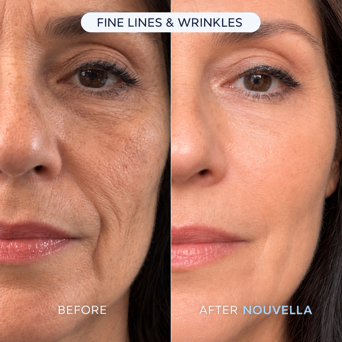 NOUVELLA Balm