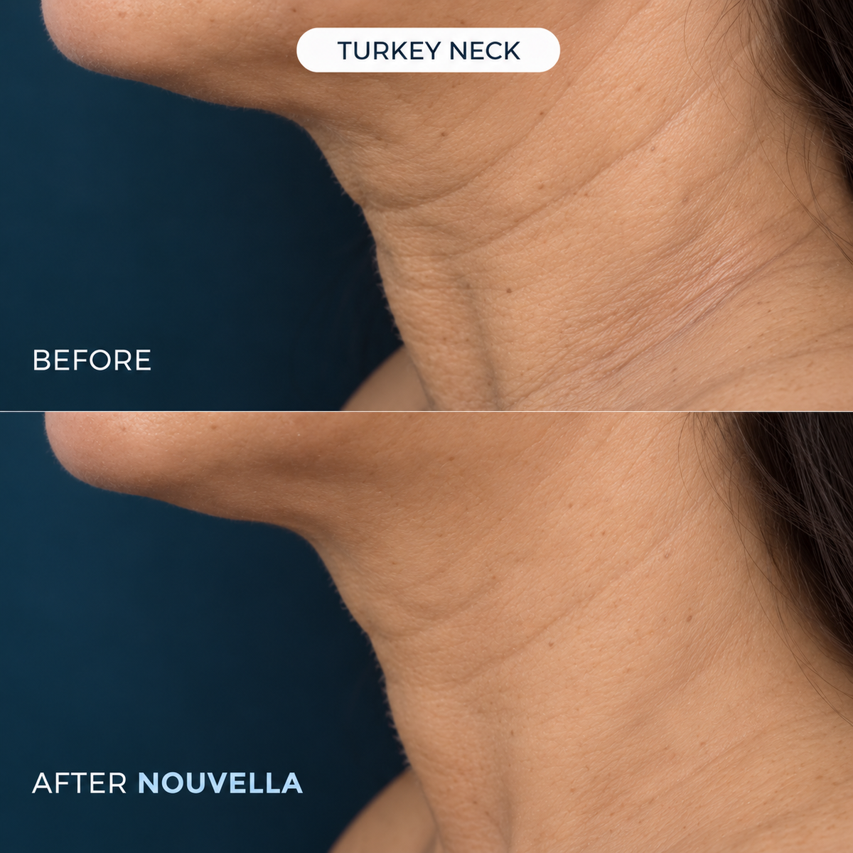 NOUVELLA Balm