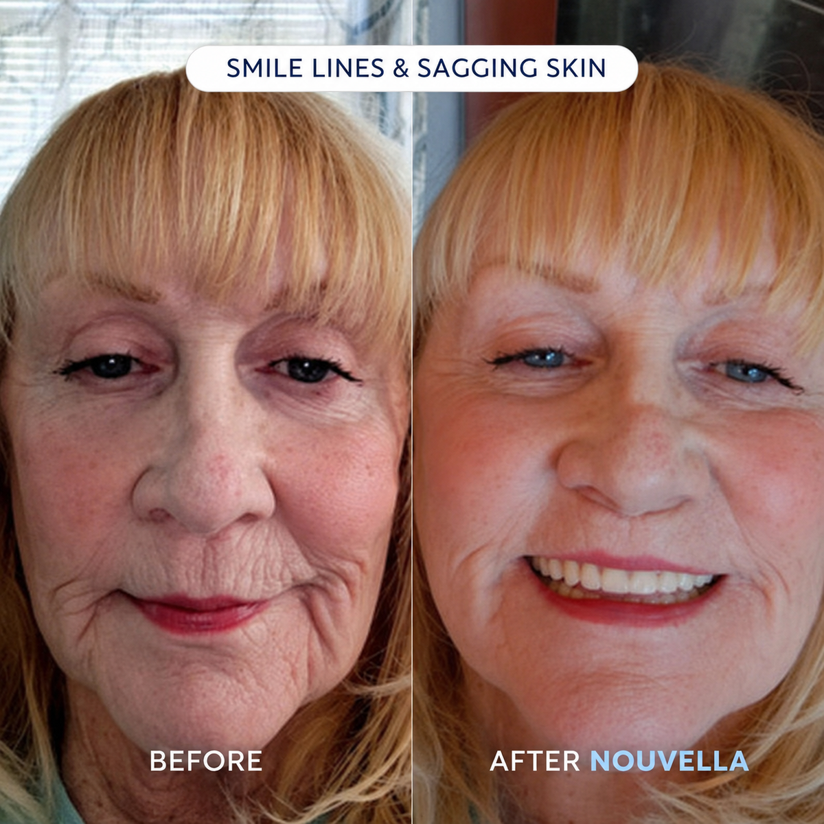 NOUVELLA Balm